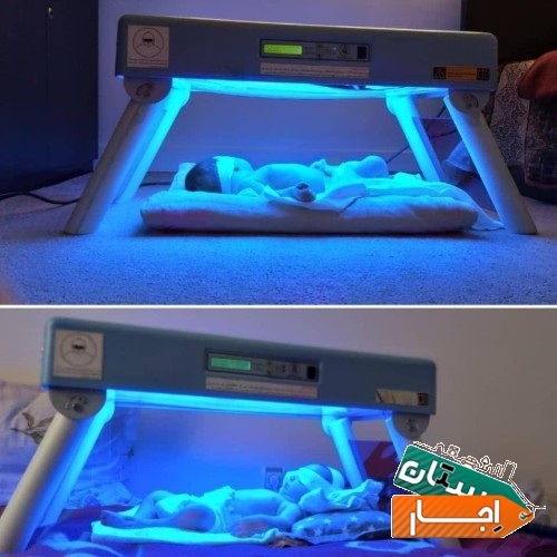 اجاره دستگاه زردی و خدمات