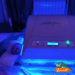 اجاره دستگاه درمان زردی نوزاد در تهران با بهترین شرایط
