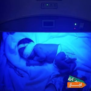 اجاره دستگاه زردی نوزاد 24 ساعته تمام نقاط تهران