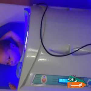 اجاره دستگاه و تست زردی نوزاد شبانه روزی کل تهران با بهترین شرایط