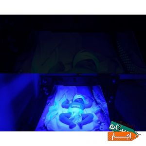 اجاره دستگاه زردی نوزاد همه مناطق شبانه روزی