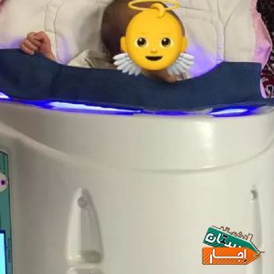 اجاره دستگاه زردی نوزاد (2021) تمامی مناطق تهران با بهترین شرایط