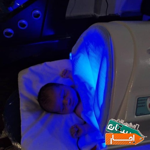 خدمات اجاره دستگاه زردی نوزاد