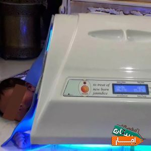 اجاره دستگاه زردی نوزاد/فتوتراپی