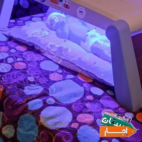 خدمات اجاره دستگاه زردی نوزاد درمنزل شبانه روزی تضمینی
