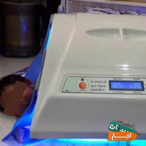 اجاره دستگاه زردی نوزاد/فتوتراپی