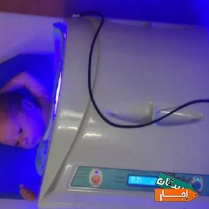 اجاره دستگاه و تست زردی نوزاد شبانه روزی کل تهران با بهترین شرایط