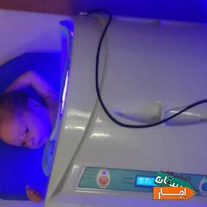 اجاره دستگاه و تست زردی نوزاد شبانه روزی کل تهران با بهترین قیمت