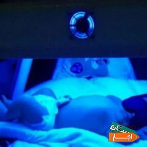 اجاره دستگاه زردی نوزاد 50.000 با بهترین امکانات