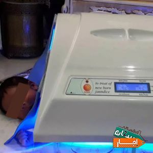 اجاره دستگاه زردی نوزاد/فتوتراپی