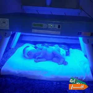 اجاره دستگاه فتوتراپی زردی نوزاد