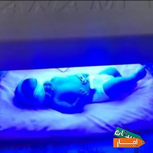 اجاره دستگاه زردی نوزاد و شیردوش برقی در منزل .