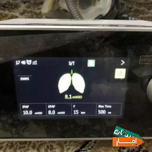اجاره دستگاه ونتیلاتور