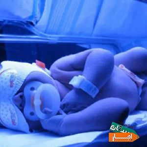 اجاره دستگاه زردی نوزاد 3D کل تهران شبانه روزی با مناسبترین شرایط