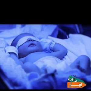 اجاره دستگاه زردی نوزاد (فتوتراپی) با بهترین امکانات
