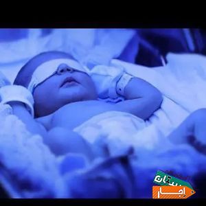 اجاره دستگاه زردی نوزاد (فتوتراپی) با بهترین امکانات