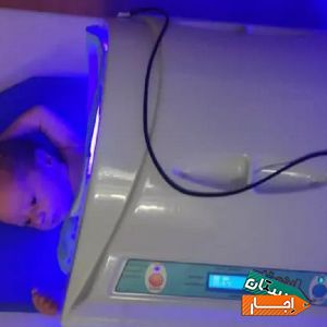 اجاره دستگاه و تست زردی نوزاد شبانه روزی کل تهران با بهترین امکانات