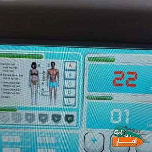اجاره دستگاه لیزر حذف موهای زائد لومینا آیس با مناسب ترین قیمت