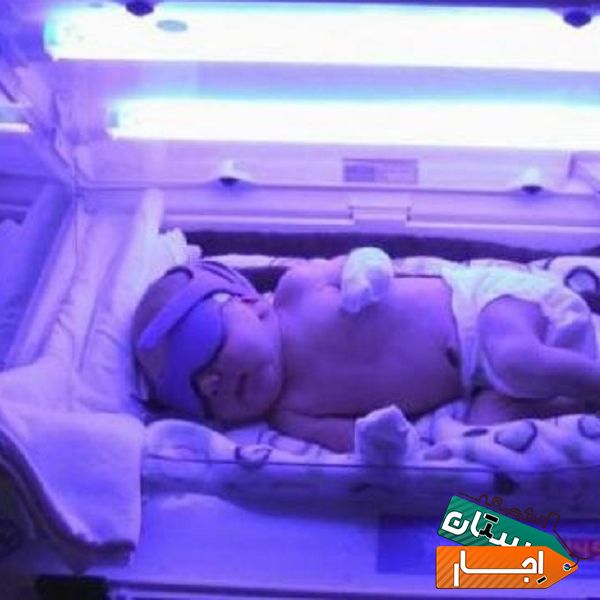 اجاره دستگاه زردی نوزاد(فتوتراپی)