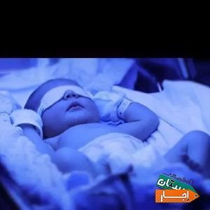 اجاره دستگاه زردی نوزاد (فتوتراپی) با بهترین امکانات