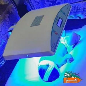 اجاره دستگاه زردی نوزاد 4D(فتوتراپی)با بهترین قیمت