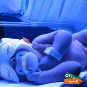 اجاره دستگاه زردی نوزاد 3D کل تهران شبانه روزی