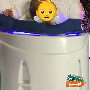اجاره دستگاه زردی نوزاد (2021) تمامی مناطق تهران با بهترین قیمت