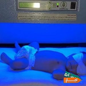 اجاره دستگاه زردی نوزاد و شیردوش برقی بیمارستانی با مناسب ترین قیمت