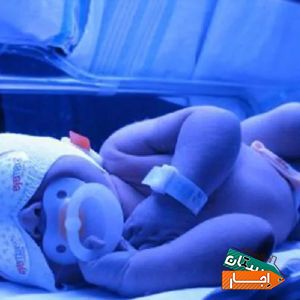 اجاره دستگاه زردی نوزاد 3D کل تهران شبانه روزی