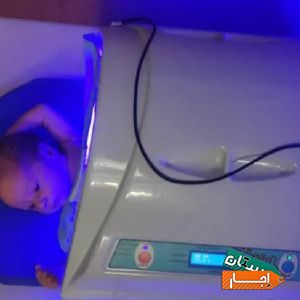 اجاره دستگاه و تست زردی نوزاد شبانه روزی کل تهران با بهترین شرایط
