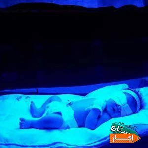 اجاره دستگاه فتوتراپی جهت درمان زردی نوزادان بابهترین امکانات