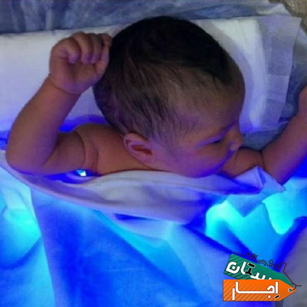 اجاره دستگاه درمان زردی نوزاد در منزل(نوپاد)