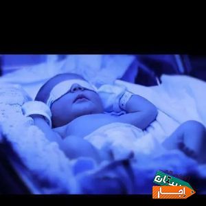 اجاره دستگاه زردی نوزاد (فتوتراپی) با بهترین شرایط