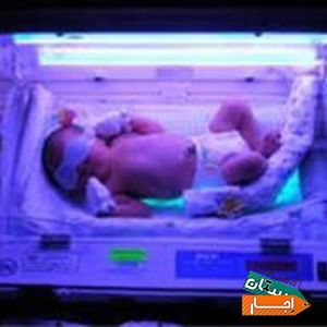 اجاره دستگاه فتوتراپی جهت درمان زردی نوزاد در منزل تهران