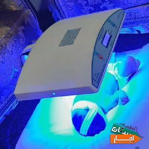 اجاره دستگاه زردی نوزاد 4D(فتوتراپی) با بهترین امکانات