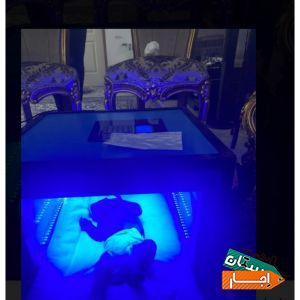 اجاره دستگاه زردی نوزاد /فتوتراپی(سراسر کرج)