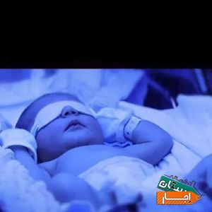 اجاره دستگاه زردی نوزاد (فتوتراپی) با بهترین شرایط
