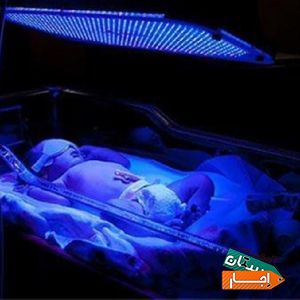 اجاره دستگاه فتوتراپی جهت درمان زردی نوزاد در منزل