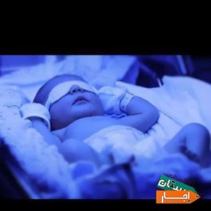 اجاره دستگاه زردی نوزاد (فتوتراپی) با بهترین شرایط