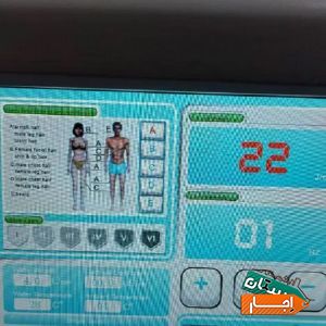 اجاره دستگاه لیزر حذف موهای زائد لومینا آیس با بهترین شرایط