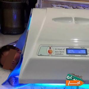 اجاره دستگاه زردی نوزاد/فتوتراپی