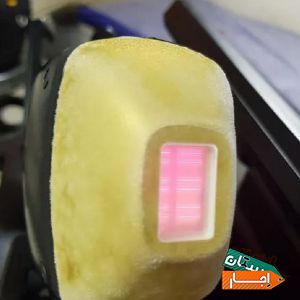 اجاره دستگاه لیزر موهای زائد سوپرانو دایود الکس با بهترین امکانات