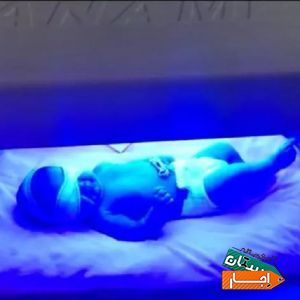 اجاره دستگاه زردی نوزاد و شیردوش برقی در منزل .