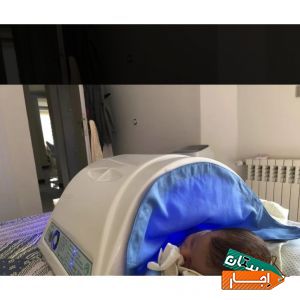 اجاره دستگاه زردی نوزاد (فتوتراپی)تمام مناطق تهران