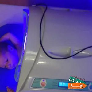 اجاره دستگاه و تست زردی نوزاد شبانه روزی کل تهران با بهترین امکانات