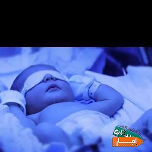 اجاره دستگاه زردی نوزاد (فتوتراپی) با بهترین کیفیت