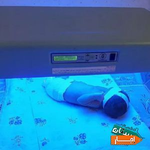 اجاره دستگاه زردی نوزاد و تست زردی در منزل با بهترین امکانات