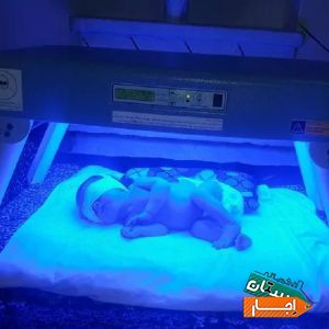 زردی نوزاد اجاره دستگاه فتوتراپی با بهترین امکانات